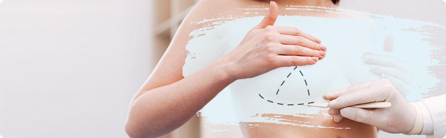 Breast Augmentation Dubai | Breast Enlargement | Implants